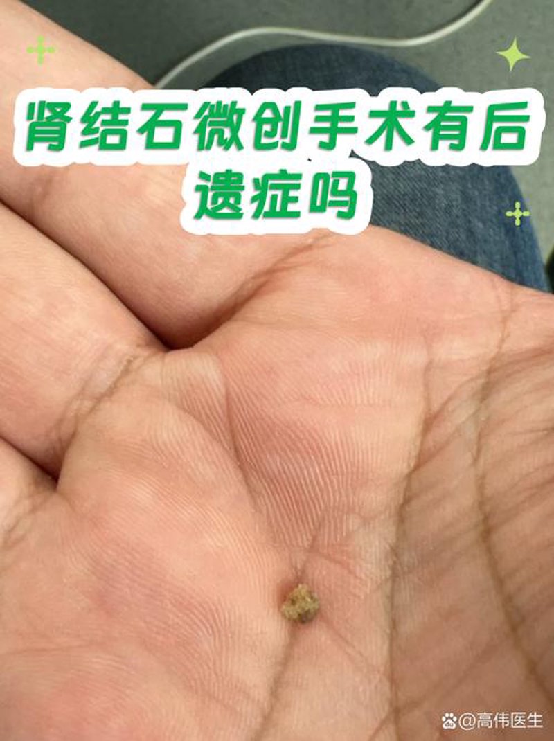泌尿外科专科医院