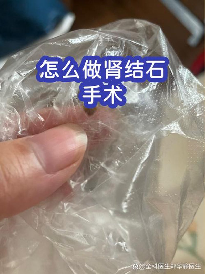 泌尿系统健康——选择杭州的优质医院成主流